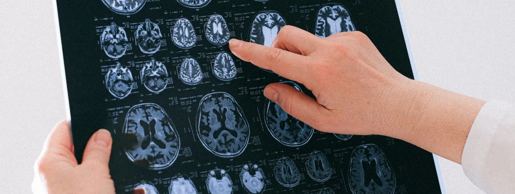 a hand pointing at a sheet of MRI brain scans
