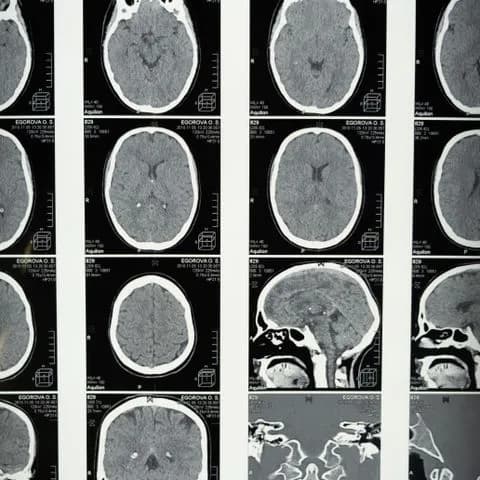 a grid of MRI brain scans