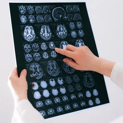 a hand pointing at a sheet of MRI brain scans