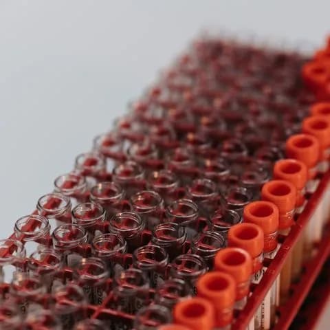 red-capped sample tubes in a tray