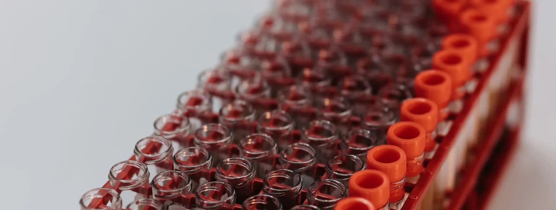 red-capped sample tubes in a tray